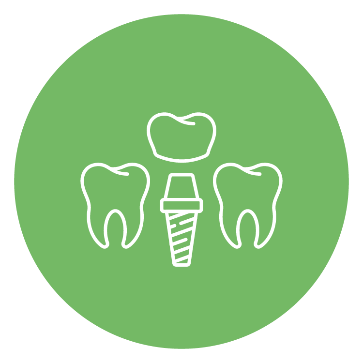 Single Tooth Implant