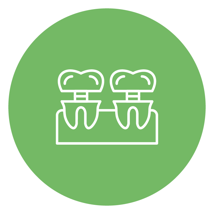 Multiple Teeth Implants