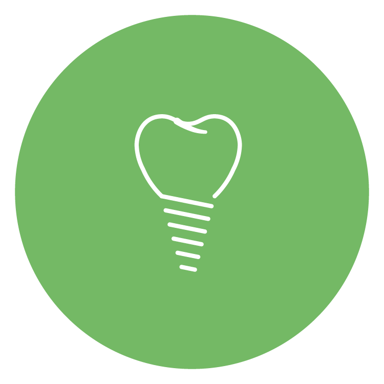 Full Mouth Dental Implants