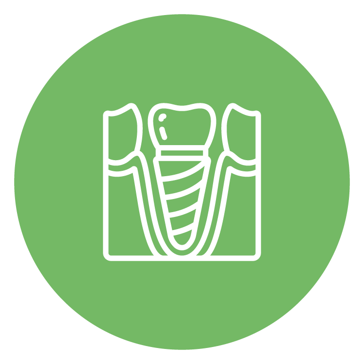 Implant-Supported Dentures